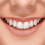 Knowing More About Orthodontic Treatments